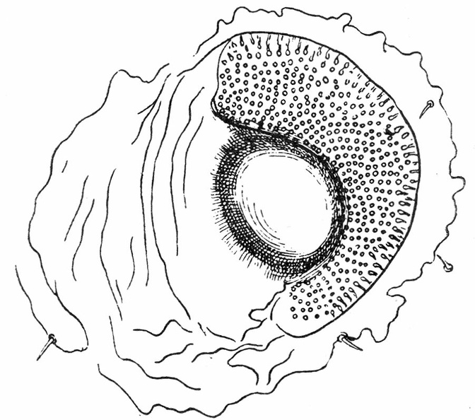 Left spiracle of nymph of Argas persicus.jpg