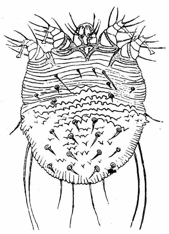 Sarcoptes scabiei, female.jpg