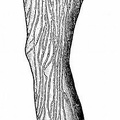 Lymphatics of the leg.