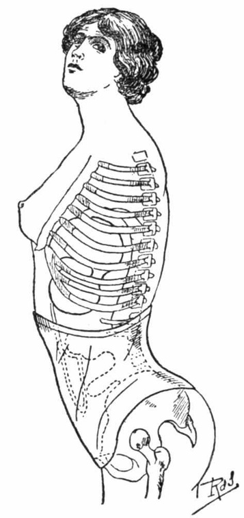 The abdominal corset.jpg