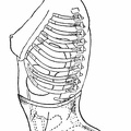 The abdominal corset