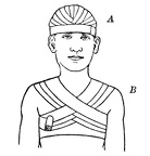 A, Recurrent bandage of the head - B, anterior figure-of-eight bandage of the chest