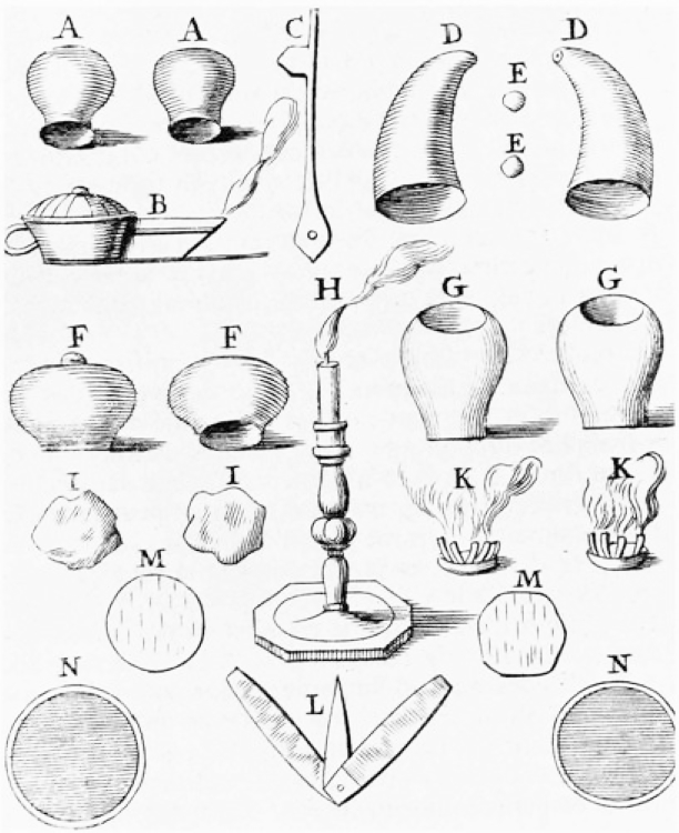 Cupping Instruments.jpg